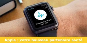 coeur apple watch